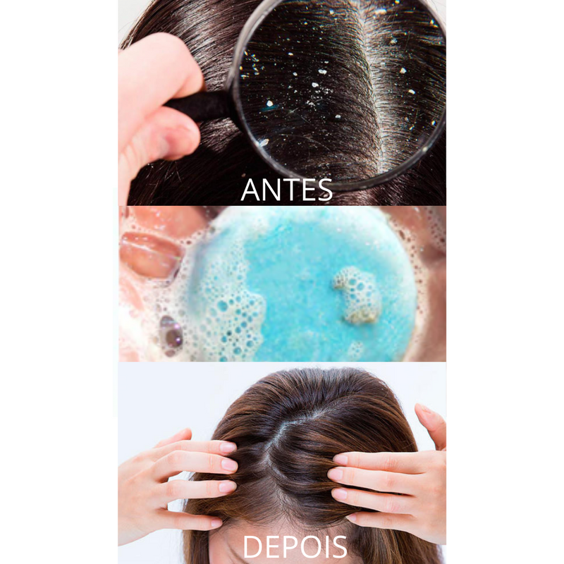 SHAMPOO ORGÂNICO ANTI-CASPAS